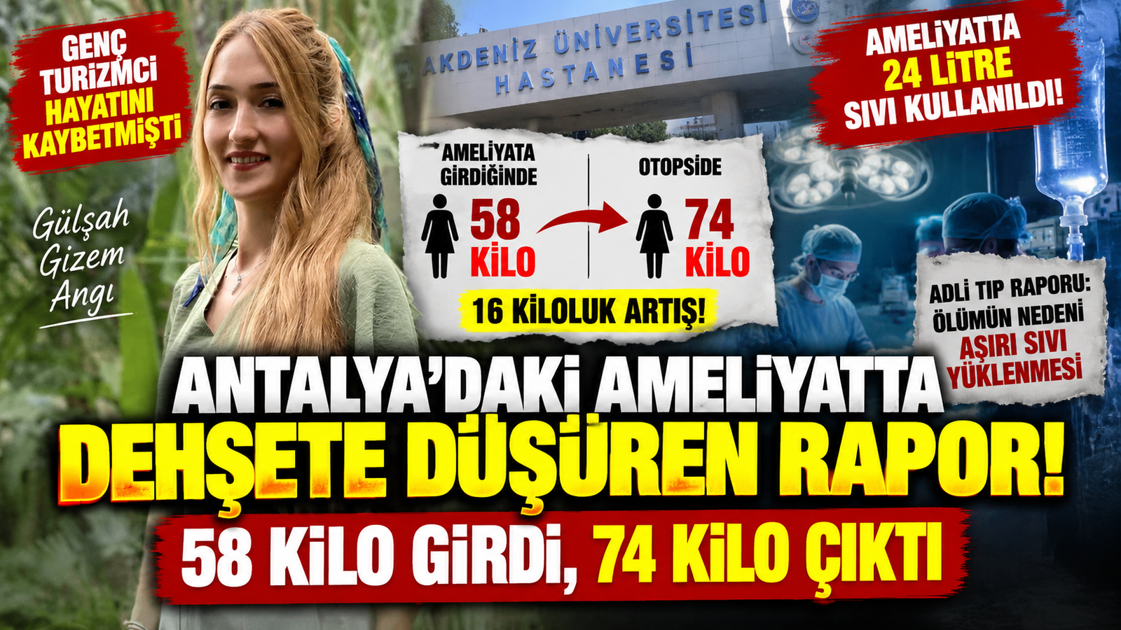 Antalya’daki Ameliyatta Dehşete Düşüren Rapor! 58 Kilo Girdi, 74 Kilo Çıktı